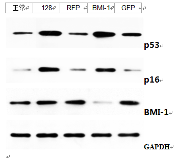 免疫印迹(western-blot)技术服务